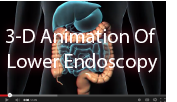 click here to view a 3-D animation of a lower endoscopy